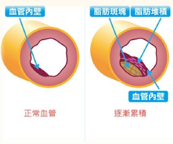 血管示意圖
